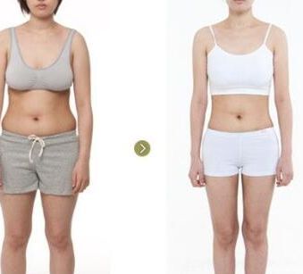 廣州去疤整形醫(yī)院排名前三公布，醫(yī)療界為之驚嘆！