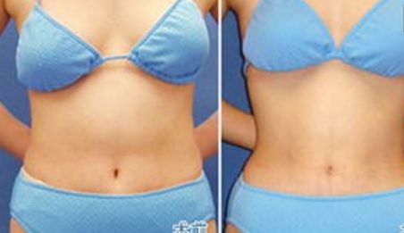 衡陽(yáng)比較好的醫(yī)院美容科專家團(tuán)隊(duì)推薦，價(jià)格公開(kāi)透明！