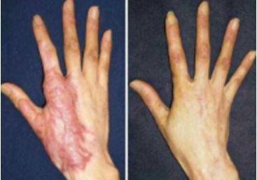 南方醫(yī)院4位胸部整形專(zhuān)家，您更推薦哪位主任？