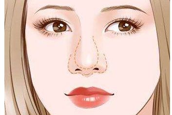 濟(jì)南哪家醫(yī)生做雙眼皮效果好？謝燕燕醫(yī)生實(shí)力及案例揭秘！