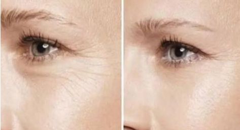 2023最佳杭州雙眼皮整形醫(yī)院排行榜揭曉！讓你雙眼瞬間變迷人的十大選擇！