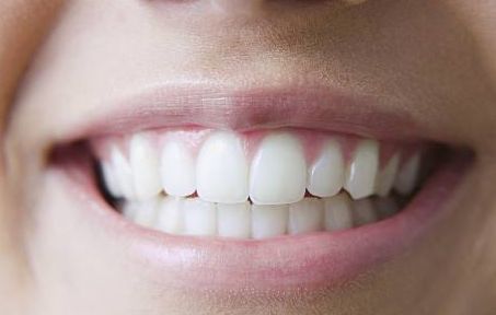 上海九院周慧芳醫(yī)生的雙眼皮手術(shù)效果一覽