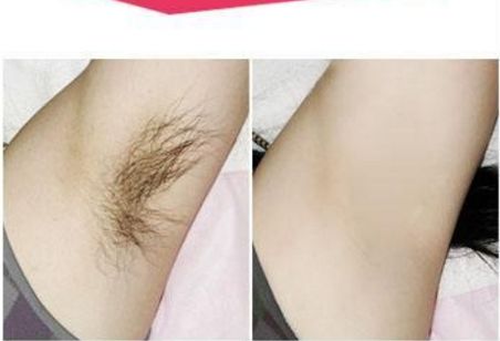 鄭大一附院整形科：專家門診時間及預約價目參考