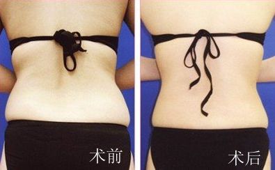 廣州非常受歡迎的整形專家解密！揭秘絕頂名醫(yī)，為你帶來(lái)全新穎解析！