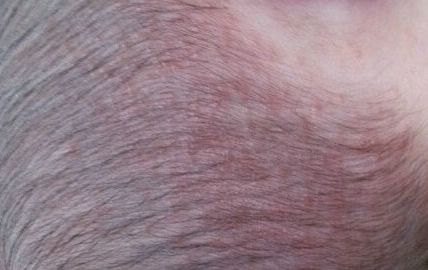 大慶彤銘醫(yī)學(xué)美容診所：體驗吸脂手術(shù)的醫(yī)生詳解與術(shù)后心得分享