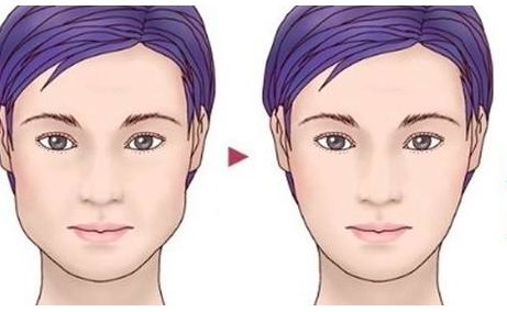 上海著名整形醫(yī)生李圣利的鼻子審美效果如何？網(wǎng)友親身經(jīng)歷分享實(shí)例。