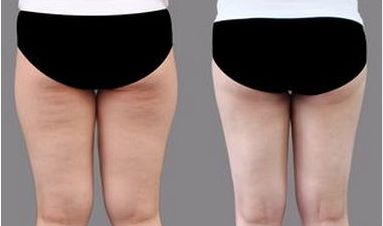 上海頂尖整容醫(yī)師團(tuán)隊(duì)曝光：專為改善臉型而生！