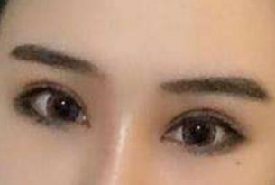 成都大華整形醫(yī)院醫(yī)生有哪些擅長項目？醫(yī)院技術如何？