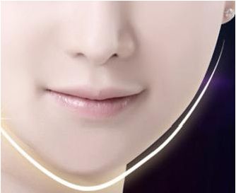 大連趙穆欣雙眼皮整形：專家實力與成功案例匯總！