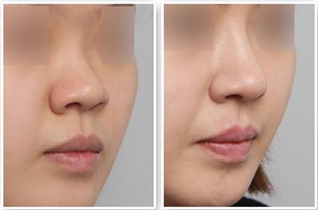 廣州愛來醫(yī)療美容門診部口碑怎么樣？醫(yī)院醫(yī)生和地址如何？門診部真的靠譜嗎？