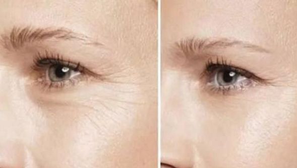 徐州二院哪位醫(yī)師擅長雙眼皮手術(shù)？權(quán)威推薦榜單+手術(shù)費用明細參考