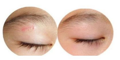 山東省最受推崇的雙眼皮手術醫(yī)院排名公布！專家推薦，精選高評分！