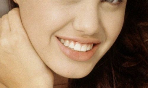 北京八大處整形外科院內(nèi)資深專家團(tuán)隊(duì)帶您探尋雙眼皮案例精彩賞析