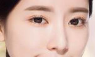 上海薇琳全身吸脂效果好嗎？