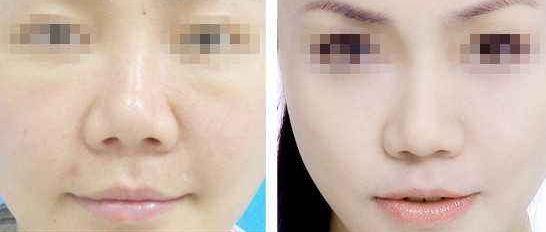 尋找北京推薦的雙眼皮修復(fù)醫(yī)療中心