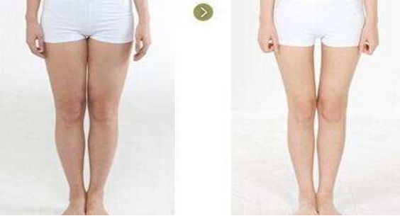 2023年上海副乳吸脂手術(shù)七大名醫(yī)推薦，醫(yī)生排行榜震撼來襲