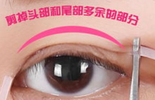 樂(lè)山市人民醫(yī)院眼袋手術(shù)口碑如何？醫(yī)生推薦+真實(shí)案例分析