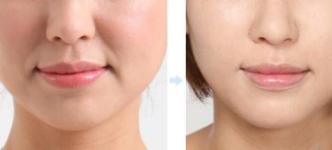 上海最佳隆鼻醫(yī)生推薦！5位實(shí)力醫(yī)生值得參考