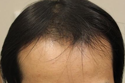 徐州市中心醫(yī)院整形美容科技術(shù)如何？周同葵主任能否提供擅長(zhǎng)項(xiàng)目信息？