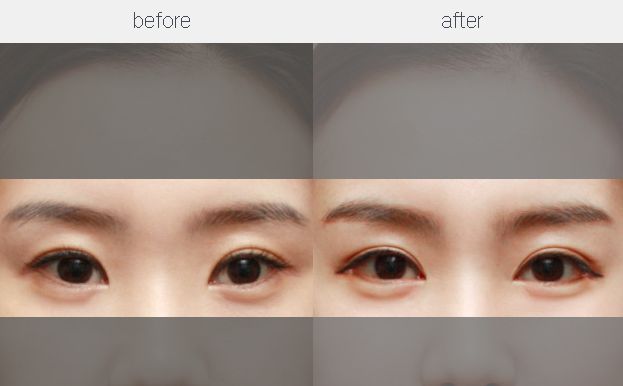 【特約】重慶鼻整形手術(shù)修復(fù)醫(yī)生五強(qiáng)名單揭曉，專家推薦！