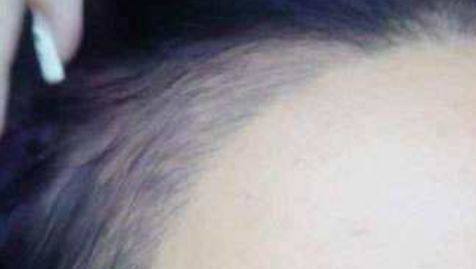 杭州隆胸醫(yī)院，解鎖完美身材，助你歡度自信人生！