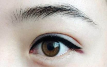 南寧醫(yī)科大雙眼皮整形費(fèi)用及技術(shù)綜述！名單與收費(fèi)指南分享