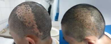 杭州有哪些專(zhuān)業(yè)技術(shù)過(guò)硬的鼻修復(fù)醫(yī)院？推薦浙江第二醫(yī)院、薇琳整形醫(yī)院、清鍇醫(yī)療美容中心等