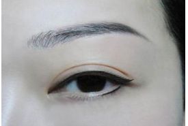 成都鼻頭縮小整形診所推薦！頂尖醫(yī)生揭秘排行榜前三強