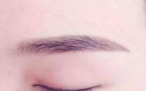 大連有哪家醫(yī)院是做鼻子手術(shù)的佼佼者？強力推薦，值得分享！