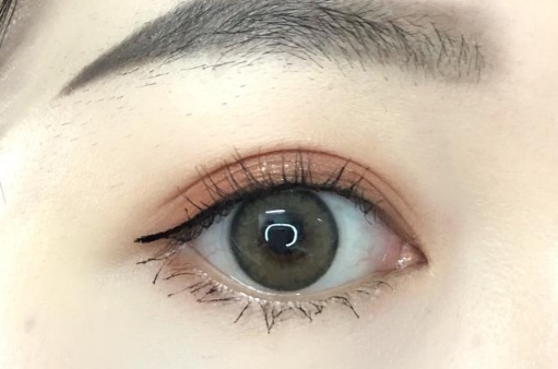 葉秀娣吸脂效果如何？值得一試嗎？