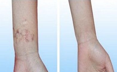 2023年武漢脫發(fā)治療獨家名單曝光！醫(yī)術嫻熟，聲譽遙遙領先！