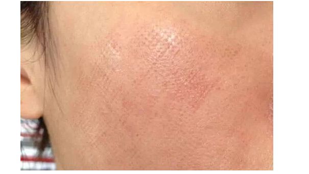 貴陽豐鼻醫(yī)生推薦TOP7專家候選已鎖定，屆時(shí)欽點(diǎn)！