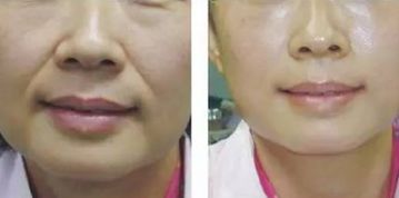 青島鼻修復(fù)：頂級專家實(shí)力享譽(yù)！唇齒相依的實(shí)力推薦