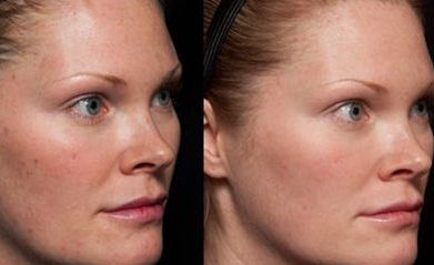 2023年南京磨骨醫(yī)生排行榜！這5位專家大咖讓您眼前一亮！