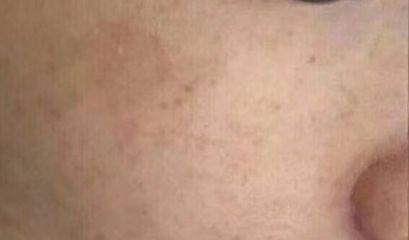 南京優(yōu)質(zhì)雙眼皮修復醫(yī)生推薦，5位專家點評述評