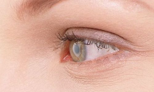 航空院眼袋手術(shù)效果如何？最新案例分享