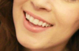 戴傳昌：一位成功鼻部整形案例分享！讓您暢享完美體驗(yàn)！醫(yī)生介紹附上！