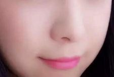 杭州哪家醫(yī)院割雙眼皮效果出眾？推薦藝星、時(shí)光、格萊美等受歡迎醫(yī)療機(jī)構(gòu)