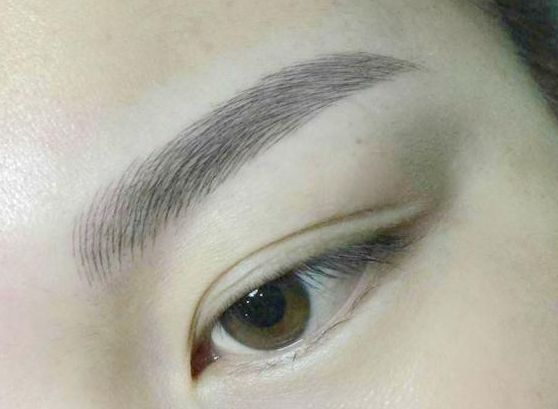 山區(qū)縮陰修復?？漆t(yī)院【這些】