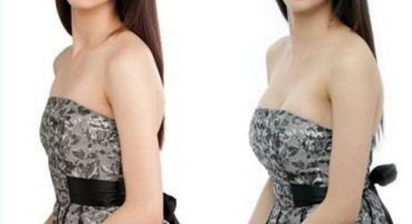 全國(guó)哪里可以找到專業(yè)的拉皮手術(shù)醫(yī)生？2023比較好幫手來了！