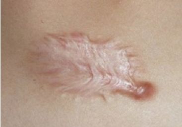 重慶上佳雙眼皮醫(yī)院推薦，口碑高的有這5家！