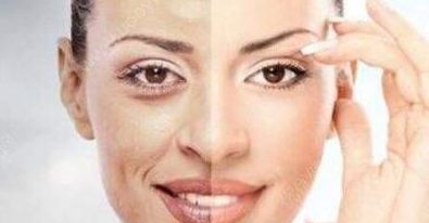 成都賈德淵醫(yī)生的眼睛技術有何不同？80天變化詳解