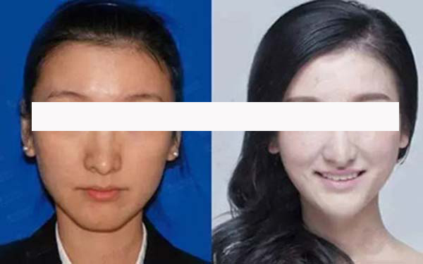 寧波藝星整形和珈禾整形，哪家更具實(shí)力？醫(yī)生口碑、項(xiàng)目擅長(zhǎng)和地址公布等方面的對(duì)比如何？