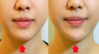 漳州五強(qiáng)醫(yī)院集結(jié)實(shí)力選手，排行榜揭曉！