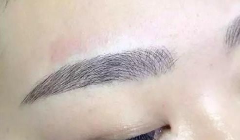 昆明祛斑哪家醫(yī)院更受歡迎？大眾口碑告訴你答案！