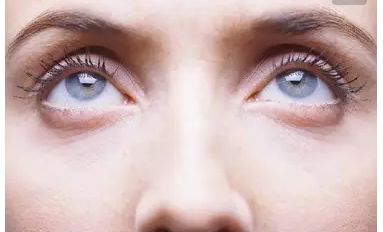 崔向葵雙眼皮整形手術(shù)效果如何？了解一下!