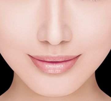 哈醫(yī)大四院李巍主治醫(yī)生鼻整形手術！80天重塑完美鼻型全記錄！