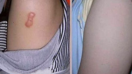 上海知名醫(yī)生手術(shù)CG費用曝光，驚人低價吸引眾多患者！