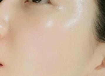 邯鄲有哪些值得推薦的吸脂整形醫(yī)院？整形醫(yī)院的選擇有哪些指標(biāo)？