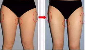 杭州隆胸能做得好的醫(yī)院是哪些？熱門推薦前十強！